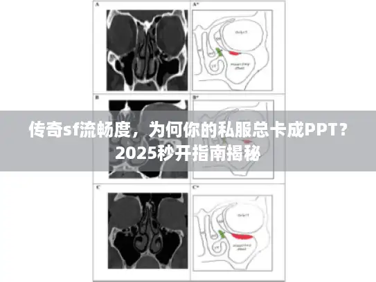 传奇sf流畅度，为何你的私服总卡成PPT？2025秒开指南揭秘