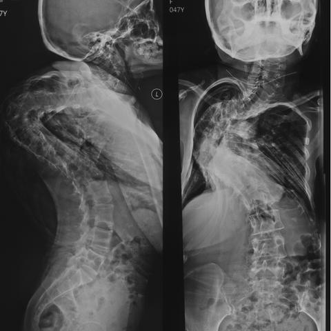 《空洞骑士丝之歌》轮椅流派攻略：打造无敌丝之歌强力流派技巧揭秘