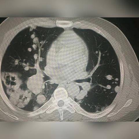 《空洞骑士》丝之歌纪元终章攻略：快速找到蘑菇先生位置技巧分享
