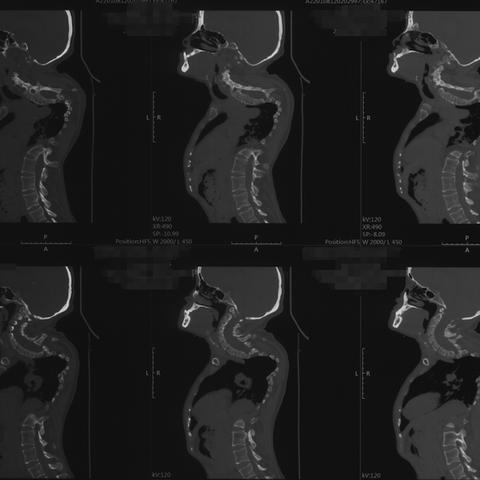 电动轮椅构筑攻略：《空洞骑士丝之歌》升级必备秘籍