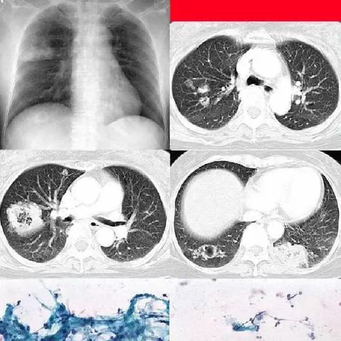 《空洞骑士》速刷念珠攻略:开局高效刷珠子技巧揭秘 《空洞骑士》速刷念珠攻略:开局高效刷珠子技巧揭秘
