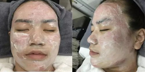 挂水后遗症：冷美人水肿重归，形象大变引关注