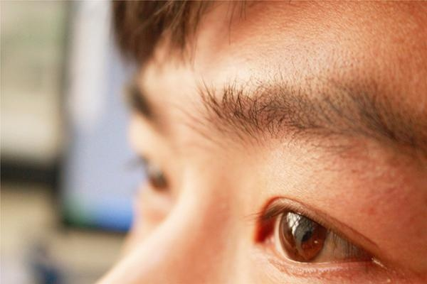 35岁男子熬夜游戏致眼中风，右眼恢复路漫漫，警惕健康风险！