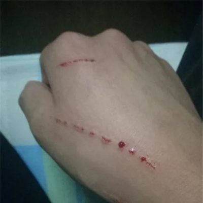 幼猫抓伤男子惨遭摔死，猫主索赔医药费遭拒引争议