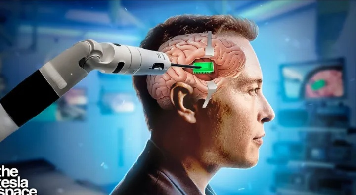 脑机接口革命！意念操控，马斯克打造全新FPS游戏体验