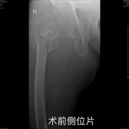 骨折玩家福音：单手也能畅玩的游戏推荐