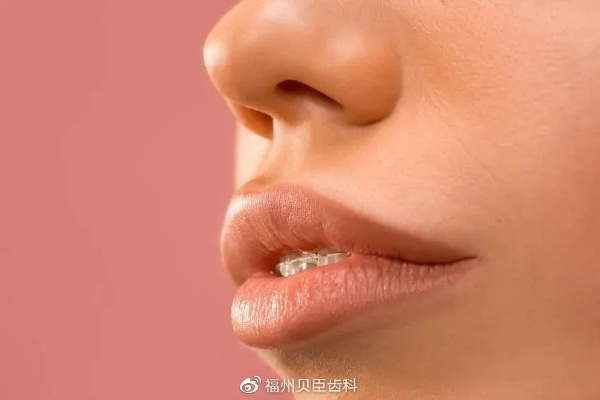 “口呼吸”热搜惊现：内娱绯闻竟致脸型变长窄，颜值危机引关注