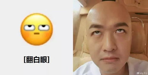红温表情包大揭秘：Bin哥双眼皮改造引热议