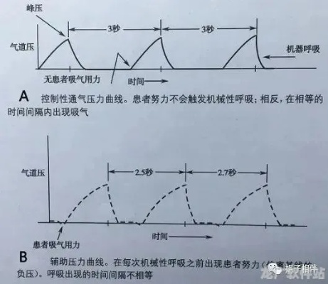 一、呼吸条管理，被90%玩家忽略的核心机制