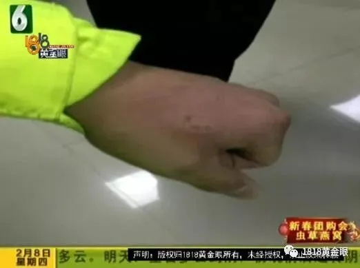 三次咬人事件全景还原与处罚轨迹