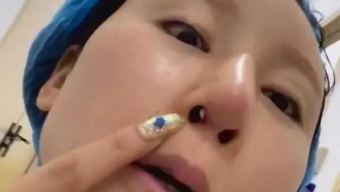 53岁女星隆胸悲剧,填充物破裂渗漏,美貌竟因此毁于一旦! 53岁女星隆胸悲剧,填充物破裂渗漏,美貌竟因此毁于一旦!