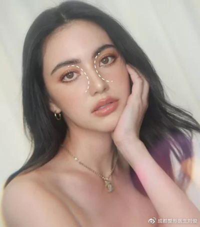 泰国性感女星Mai自曝做脸花几百万，面部僵硬连眉毛都动不了了
