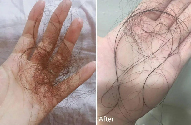 女子蓄发25年真实生存报告，从毛囊管理到社交博弈的完整实战手册