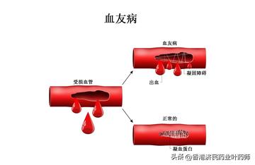血之泛滥伤害打不上去？2026流血机制深度剖析与解决方案