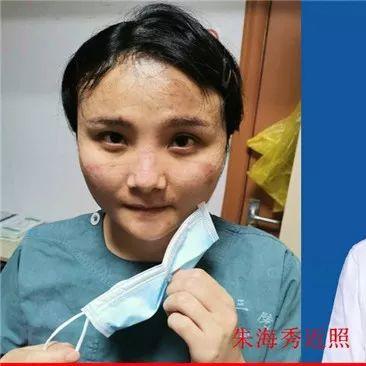 “最快女护士” 辞职后最新近况曝光！成国际健将