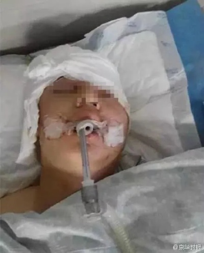 男大生挥霍骚扰后脑重启 电休克治疗改善行为 男大生挥霍骚扰后脑重启 电休克治疗改善行为