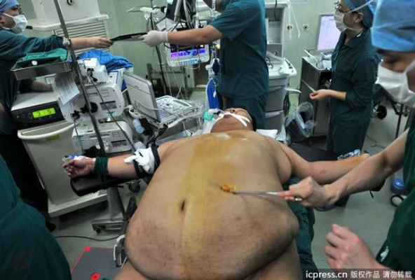 运动员退役后从146斤暴涨至523斤 手术切除75%胃